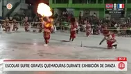 Escolar sufre graves quemaduras durante danza en Chanchamayo