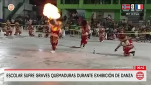 Escolar sufre graves quemaduras durante danza en Chanchamayo. Foto y video: América Noticias