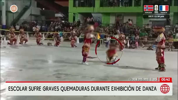 Escolar sufre graves quemaduras durante danza en Chanchamayo. Foto: América Noticias