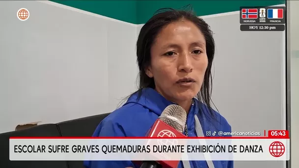 Escolar sufre graves quemaduras durante danza en Chanchamayo. Foto: América Noticias