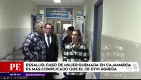 Mujer quemada en Cajamarca está en Lima. América Noticias