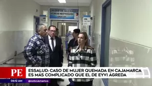 Mujer quemada en Cajamarca está en Lima. América Noticias