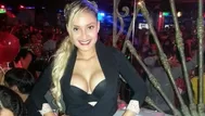 EXCLUSIVO: Nadeska Widausky habló por primera vez tras el atentado que sufrió
