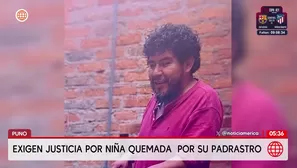 Exigen justicia por niña que sufrió quemaduras en Puno. Foto y video: América Noticias