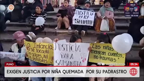 Exigen justicia por niña que sufrió quemaduras en Puno. Foto: América Noticias