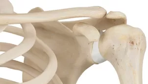 Implantes óseos impresos en 3D para regenerar el hueso. Foto: NovaCiencia