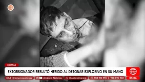 Extorsionador pierde dedos tras fallido atentado en Comas. Foto y video: América Noticias