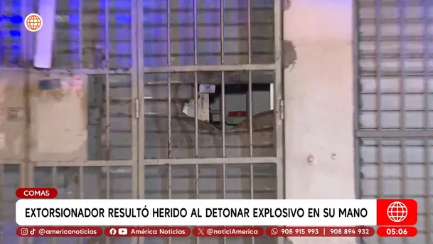 Extorsionador pierde dedos tras fallido atentado en Comas. Foto: América Noticias Extorsionador pierde dedos tras fallido atentado en Comas. Foto: América Noticias