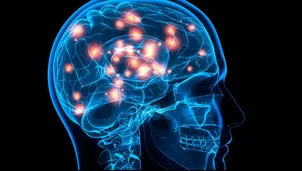 La fototerapia ayudaría a recuperación de lesiones cerebrales importantes. Foto: Radiology