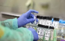 Gobierno evalúa la compra de vacuna contra la viruela del mono - Noticias de vacuna-covid-19