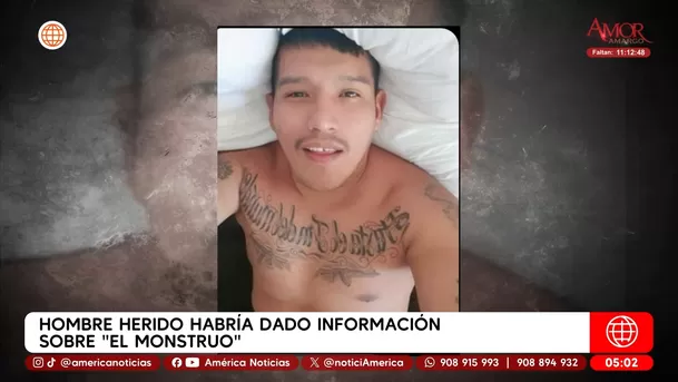 Hombre baleado habría dado información sobre alias El Monstruo. Foto: América Noticias Hombre baleado habría dado información sobre alias El Monstruo. Foto: América Noticias