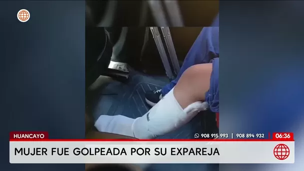 Hombre golpea a su exenamorada y a una joven en Huancayo. Foto: América Noticias Hombre golpea a su exenamorada y a una joven en Huancayo. Foto: América Noticias