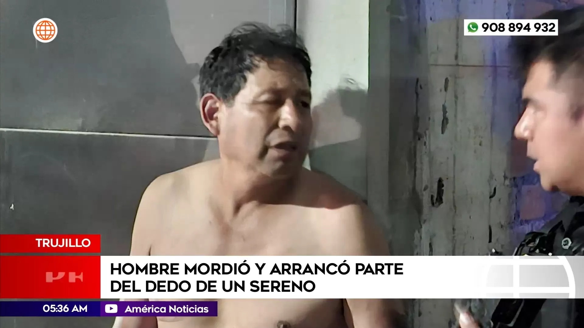 Hombre mordió y arrancó parte del dedo de un sereno en Trujillo. Foto: América Noticias