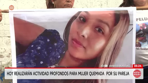 Intento de feminicidio en el Cercado de Lima: Hombre que quemó a su pareja permanece en custodia policial. Foto: América Noticias