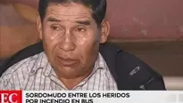 Hombre de 61 años presenta graves quemaduras en sus manos. Foto: captura de TV