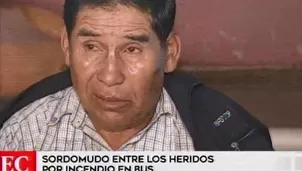 Hombre de 61 años presenta graves quemaduras en sus manos. Foto: captura de TV