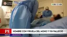 Hombre con viruela del mono y VIH falleció