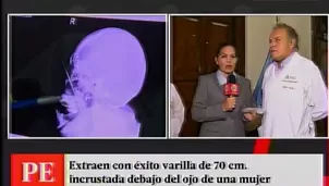 Extraen varilla de metal del rostro de una mujer. Foto: captura de TV