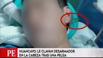 Hombre resultó herido tras una gresca. 