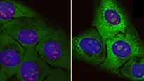 Descubren posible causa del envejecimiento y del origen de la ELA. Foto: Molecular Cell