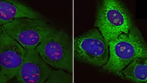 Descubren posible causa del envejecimiento y del origen de la ELA. Foto: Molecular Cell