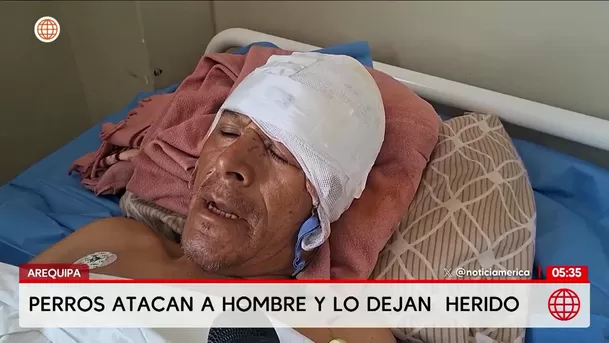 Jauría de perros ataca a hombre de 55 años en Arequipa. Foto: América Noticias
