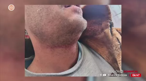 Fuente: América Noticias Fuente: América Noticias