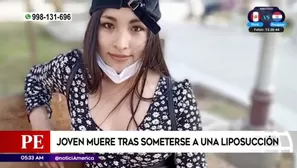 Murió tras someterse a liposucción. América Noticias