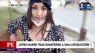 Murió tras someterse a liposucción. América Noticias