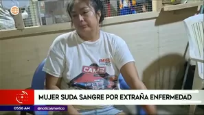 Mujer con extraña enfermedad en Loreto. Foto y video: América Noticias