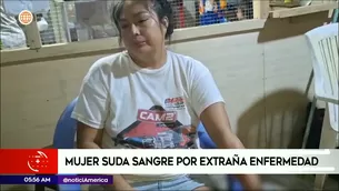 Mujer con extraña enfermedad en Loreto. Foto y video: América Noticias