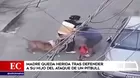  Madre queda herida tras defender a su hijo del ataque de un pitbull 