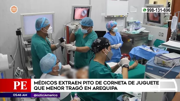 Médicos extraen pito de juguete que menor tragó en Arequipa. Foto: América Noticias