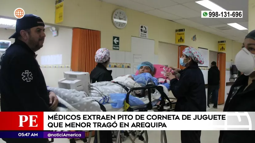 Médicos extraen pito de juguete que niño tragó en Arequipa