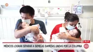 Médicos INSN San Borja separan a siamesas unidas por la columna