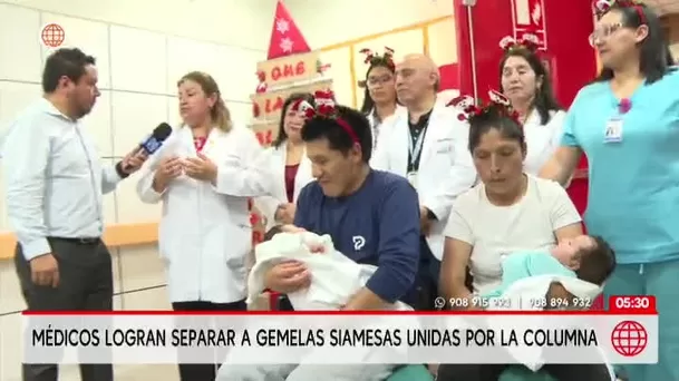 Médicos del INSN San Borja logran separar a gemelas siamesas unidas por la columna. Foto: América Noticias