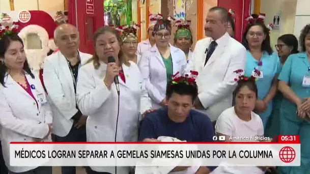 Médicos del INSN San Borja logran separar a gemelas siamesas unidas por la columna. Foto: América Noticias