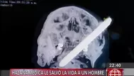 Médicos salvan vida de albañil al que se le incrustó fierro en la cabeza