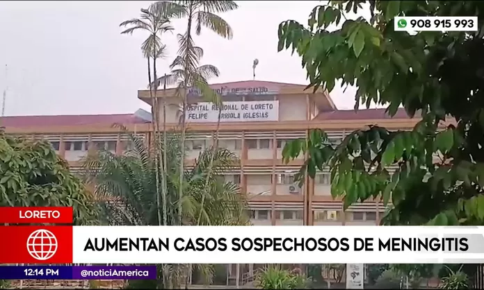 Minsa: Aumentan casos de meningitis en Loreto