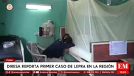 Minsa confirma primer caso de lepra en Piura tras años