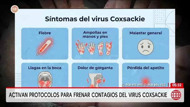 Minsa y Minedu activan protocolos por brote del virus Coxsackie. Foto: América Noticias