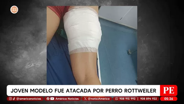 Joven modelo fue atacada por perro rottweiler en Chorrillos. Foto: América Noticias