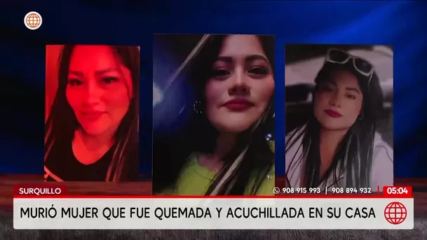 Muere Yajaira Sigueñas, mujer quemada y acuchillada en Surquillo. Foto: América Noticias