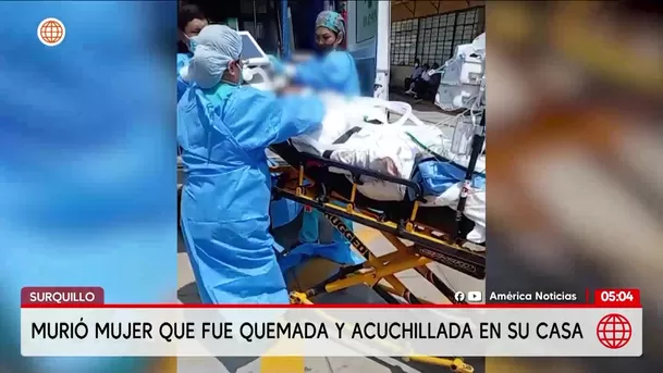Muere Yajaira Sigueñas, mujer quemada y acuchillada en Surquillo. Foto: América Noticias