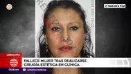 Muere mujer tras realizarse cirugía estética en Arequipa