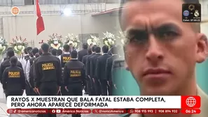 Rayos X muestran que bala fatal estaba completa, pero ahora aparece deformada. Foto y video: Unidad de investigación