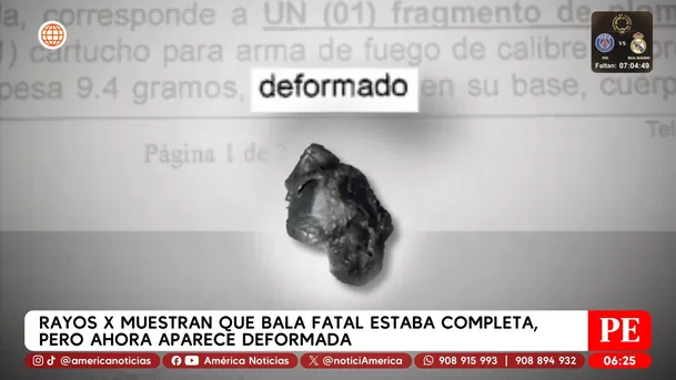 Rayos X muestran que bala fatal estaba completa, pero ahora aparece deformada. Foto: América Noticias