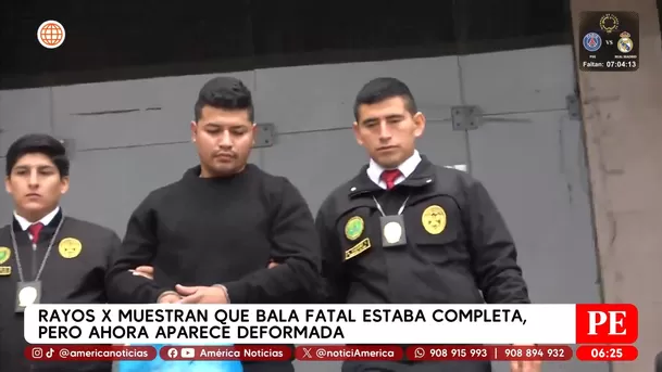 Rayos X muestran que bala fatal estaba completa, pero ahora aparece deformada. Foto: América Noticias