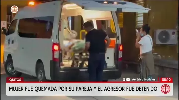 Atacan con fuego a mujer en Iquitos/ América Noticias Atacan con fuego a mujer en Iquitos/ América Noticias