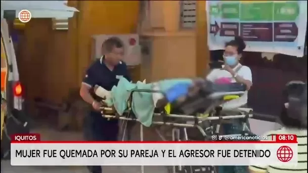 Una mujer fue atacada con fuego por su pareja/ América Noticias Una mujer fue atacada con fuego por su pareja/ América Noticias